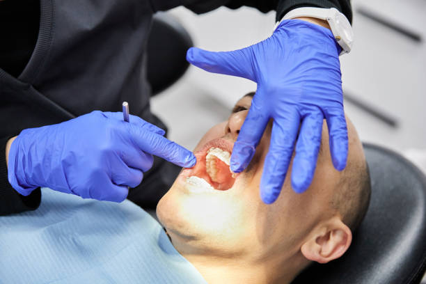 Best Emergency Dentist for Lost Fillings or Crowns in Seneca Knolls, NY